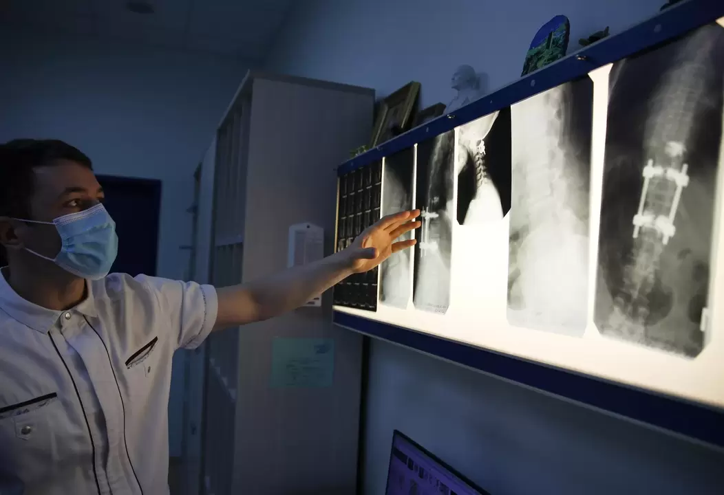 Lääkärit diagnosoivat kohdunkaulan osteokondroosin instrumentaalisilla menetelmillä, kuten röntgenkuvauksella